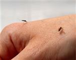 Tại sao muỗi đốt lại bị sưng và ngứa rất lâu?